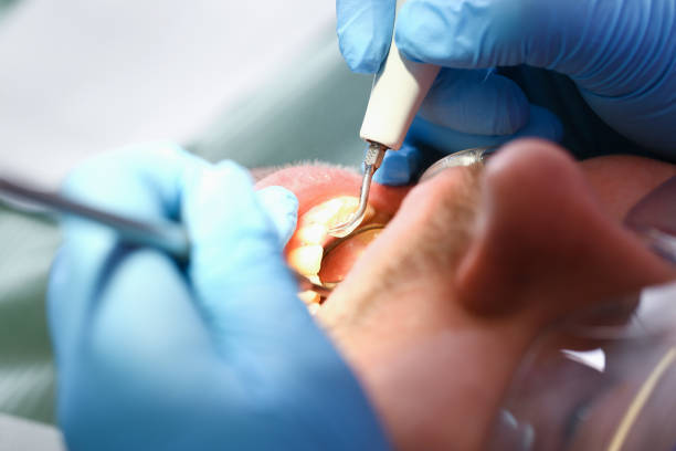 Best Emergency Denture Repair in Redondo Beach, CA